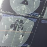 radiología digital